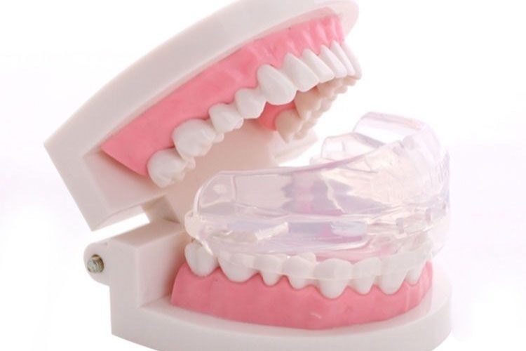 Aparelho Intra Oral em uma dentadura de exemplo