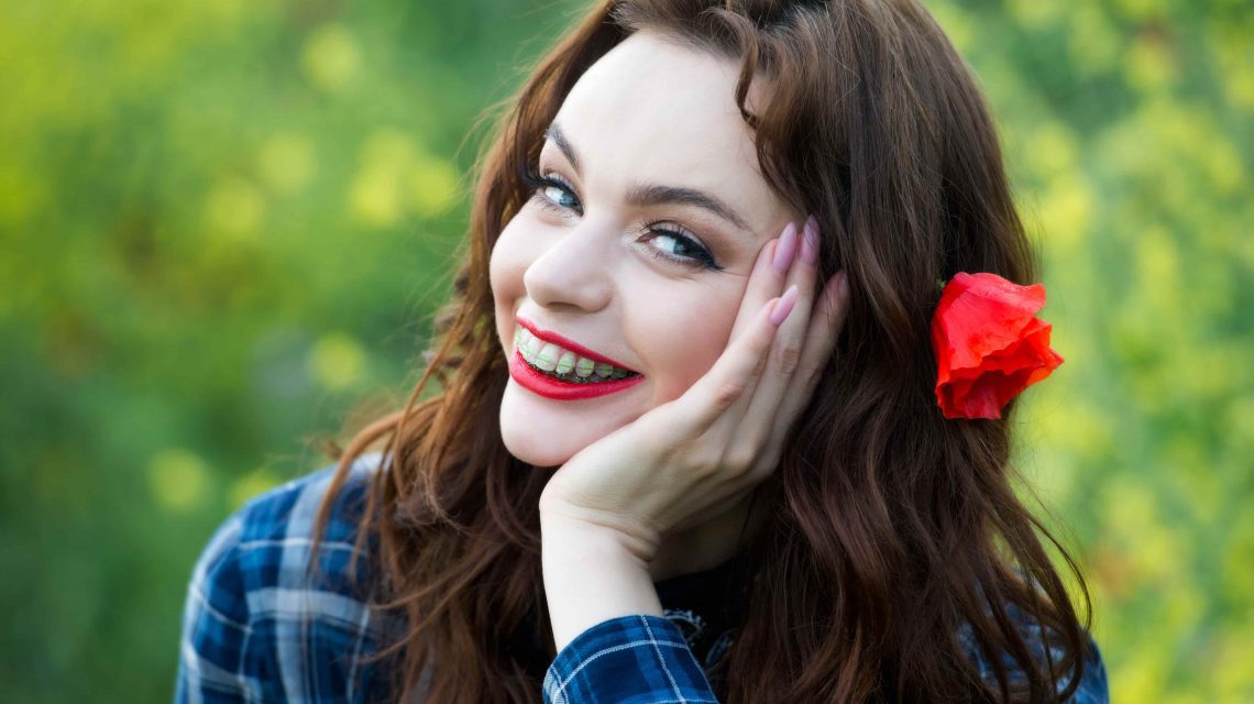 Mulher sorrindo e com aparelho metálico - Orthoclin