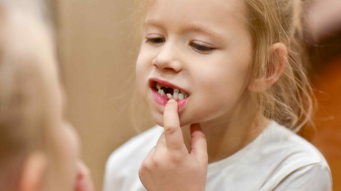 Criança sem alguns dentes