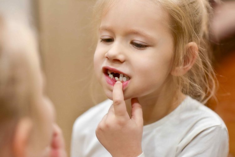 Criança sem alguns dentes