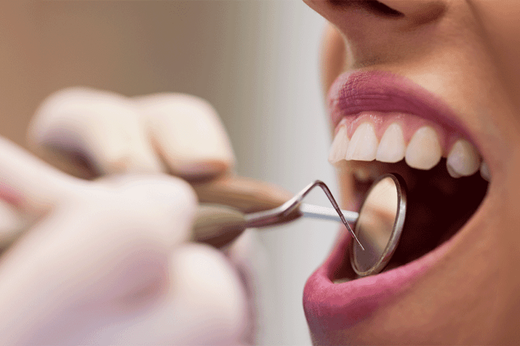 Dentista realizando exame em paciente para avaliar a saúde da gengiva e prevenir problemas bucais.