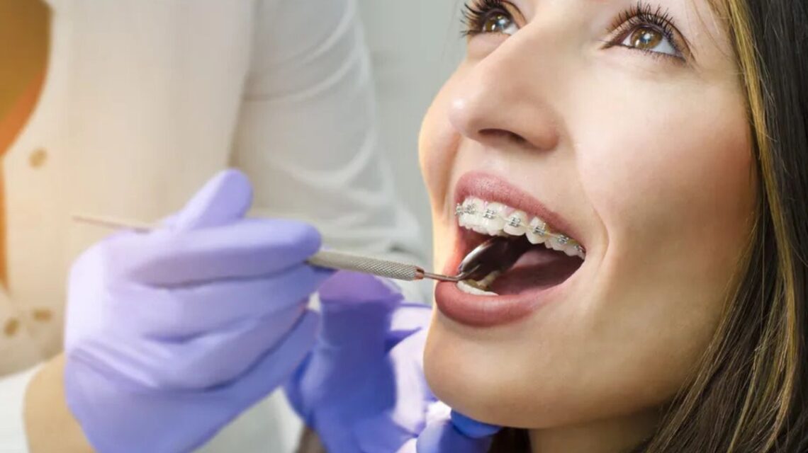 Quando se trata de alcançar o sonho de um sorriso harmonioso e uma excelente estética dental, o tratamento ortodôntico é um passo fundamental.