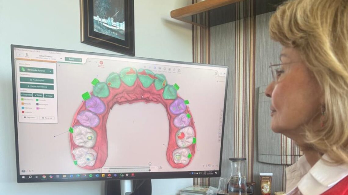 Tecnologia 3D no Alinhador Transparente — Orthoclin São José dos Campos