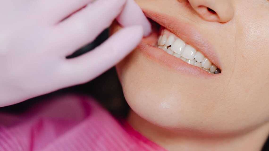 Dentição Permanente