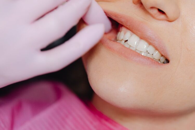 Dentição Permanente