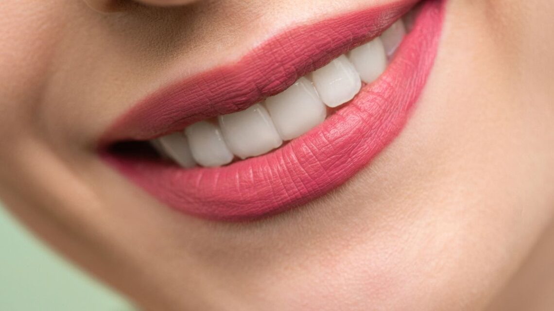 Tenha um Sorriso de Galã