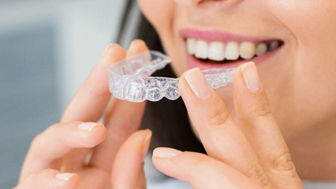 Alinhar os Dentes com Aparelho Transparente é Possível?