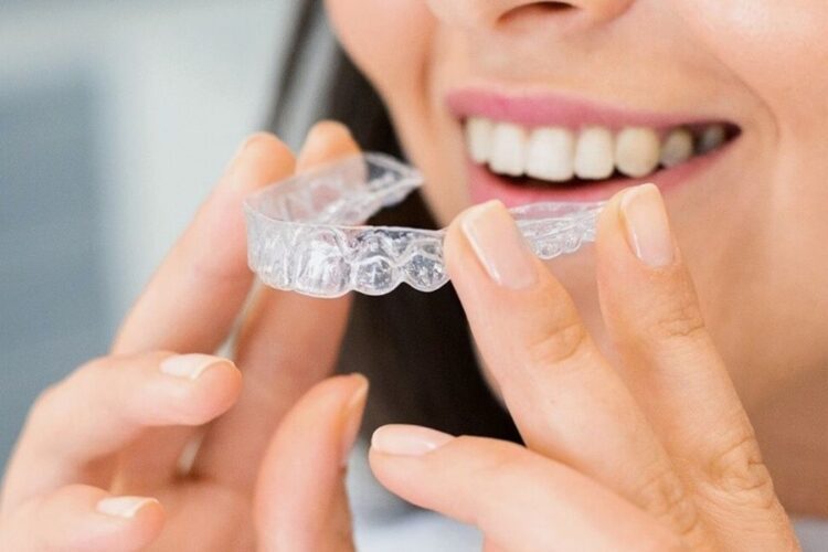 Alinhar os Dentes com Aparelho Transparente é Possível?