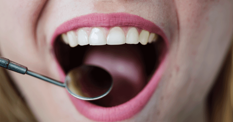 Exame dental durante o tratamento ortodôntico estética, focado no alinhamento e saúde dos dentes.
