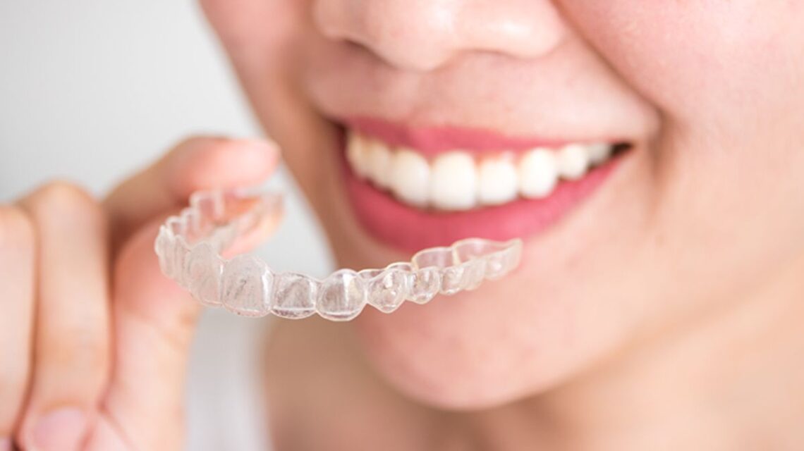 4 Benefícios do uso de alinahdores transparentes no tratamento ortodôntico