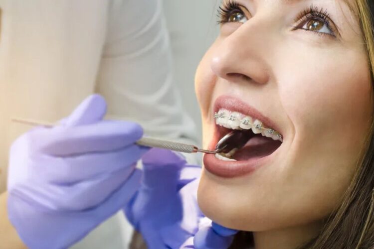 Quando se trata de alcançar o sonho de um sorriso harmonioso e uma excelente estética dental, o tratamento ortodôntico é um passo fundamental.